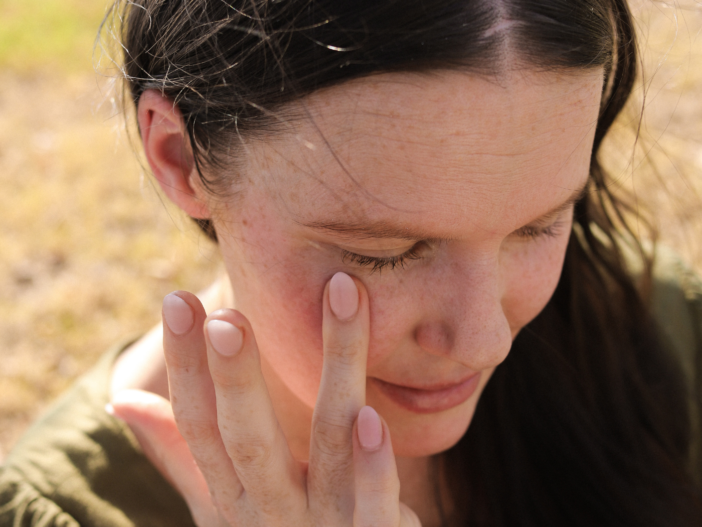 Treating & Preventing Hyperpigmentation